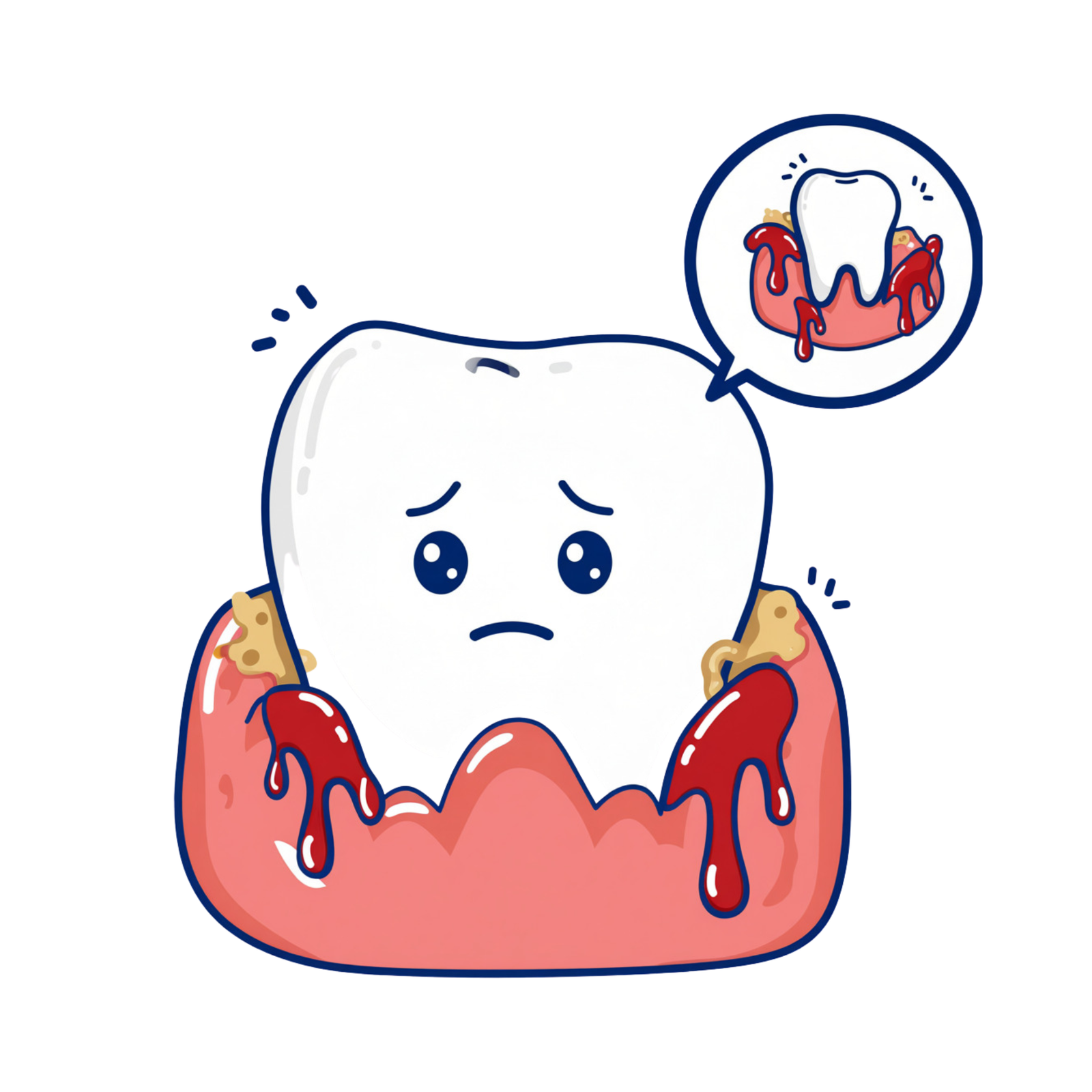 PERIODONTI